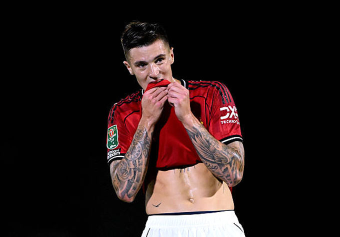 Sesko muốn đá chính trong thời gian tới tại MU