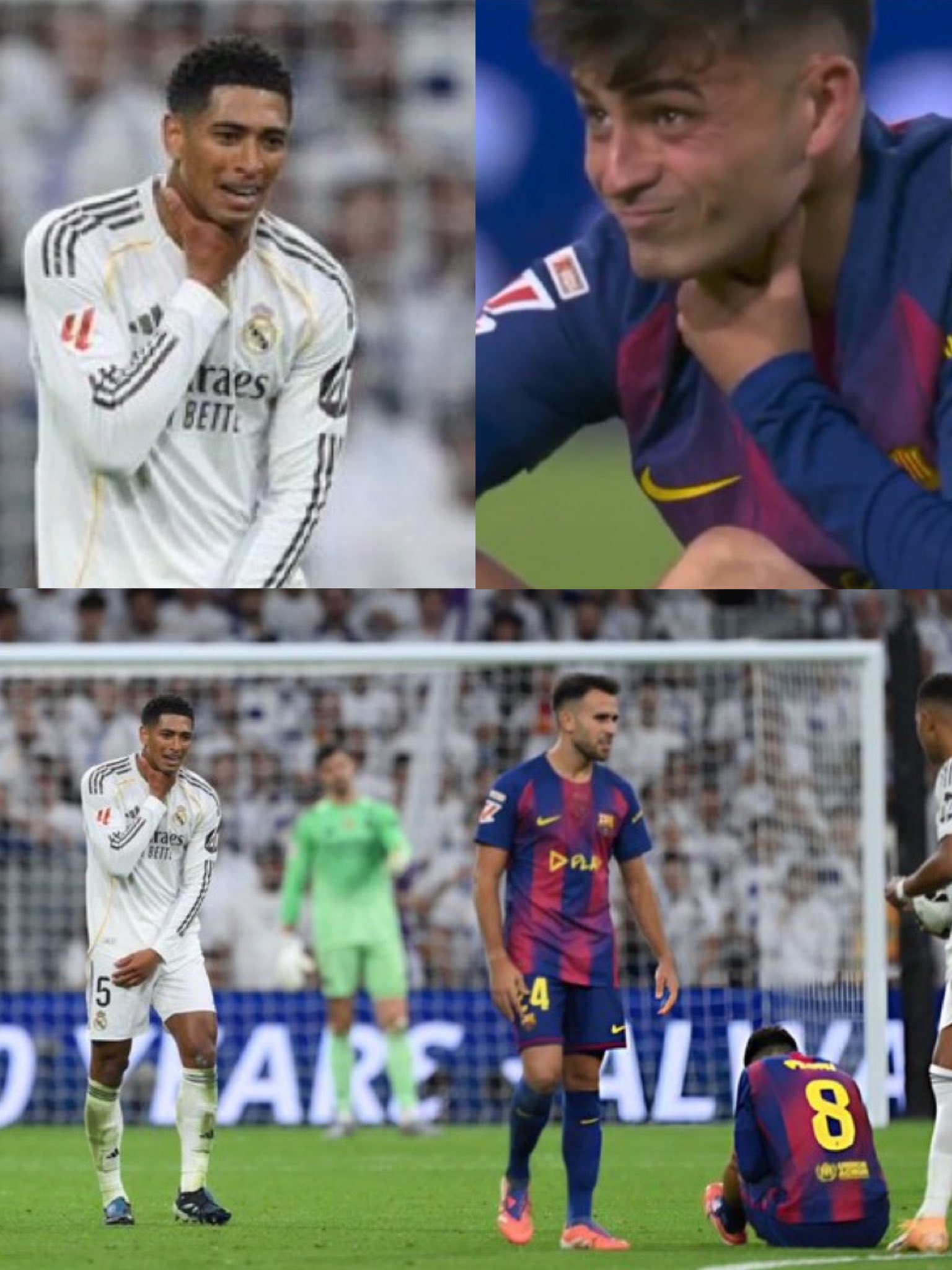 Khoảnh khắc khó coi của Bellingham