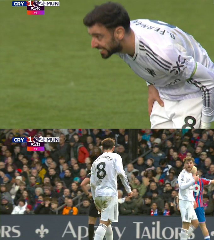 Bruno bị đau trong những phút cuối trận thắng Palace nhưng rất may là không gặp vấn đề gì lớn