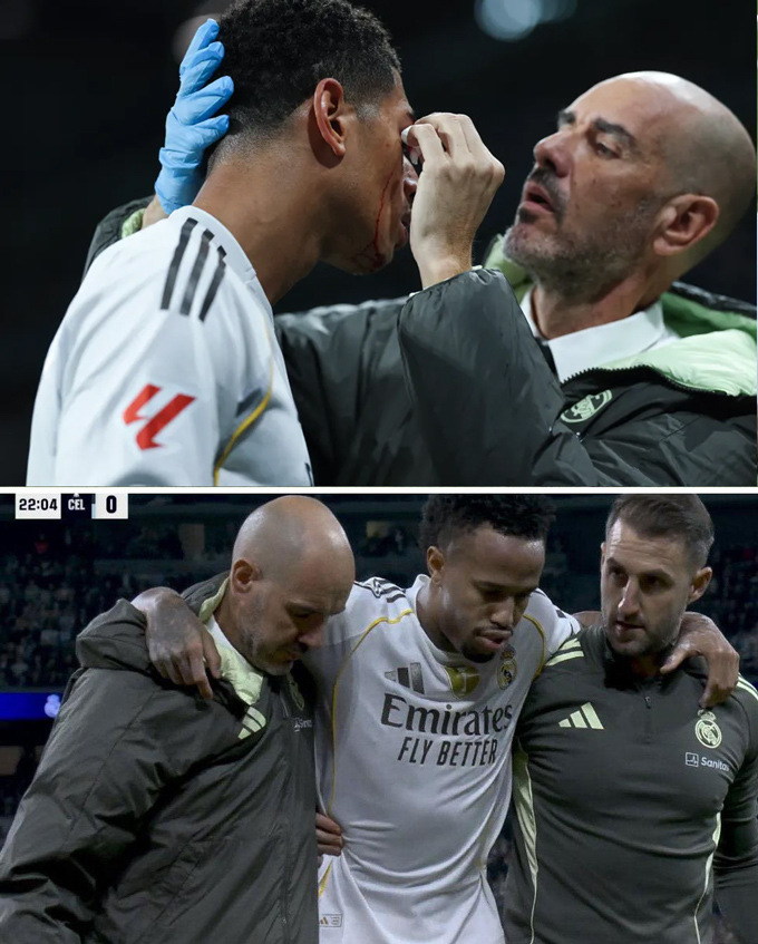 Bellingham chảy toang máu còn Militao chấn thương rời sân sớm