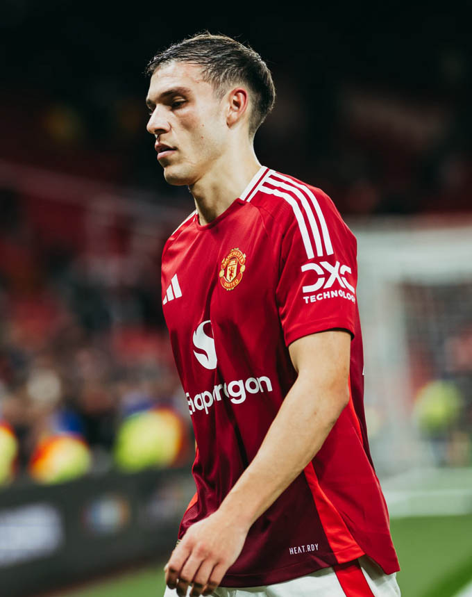 Ugarte đang chơi tệ ở MU